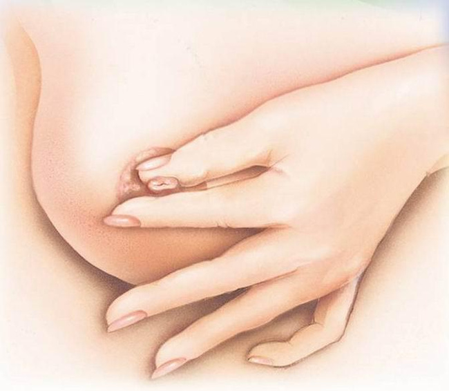 粉红120乳腺健康：乳腺增生的发病原因和临床表现